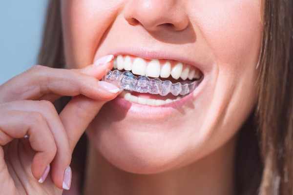 invisalign Penrith