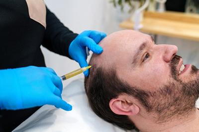Is PRP the Future of Hair Restoration? Insights from London Clinics